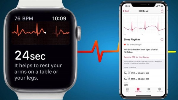 Chức năng theo dõi sức khỏe trên Apple Watch Cellular.